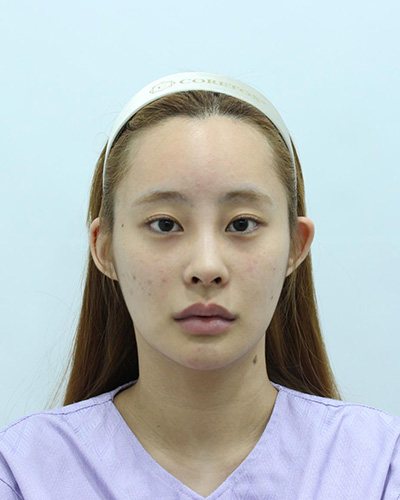 Before