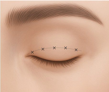 쌍꺼풀 라인 디자인 일러스트