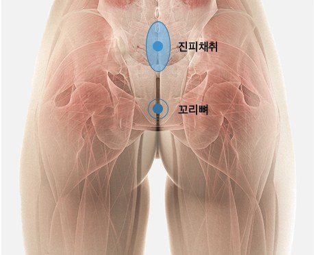 엉덩이 진피 채취 부위 해부도 일러스트