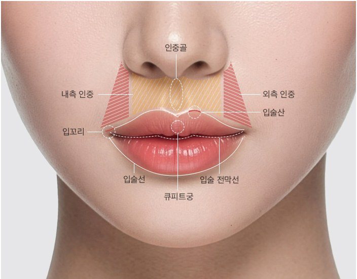 내측 인중, 외측 인중, 입술산, 인중골, 큐피트궁 등 인중과 입술 부위가 표시된 하안부 사진