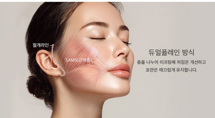 딥미니거상 듀얼플레인 방식 절개라인 및 SAMS 근막층 설명 일러스트
