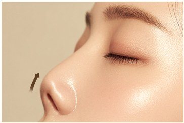 구축 코 증상을 나타낸 일러스트