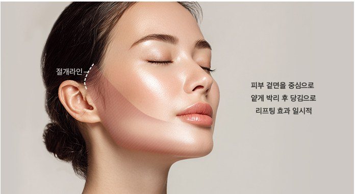 미니거상의 피부 겉면 박리 및 절개라인 설명 일러스트
