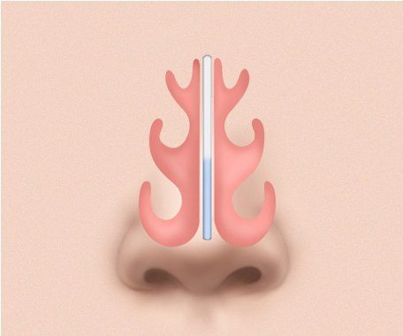 곧은 라인 고정 완료 일러스트
