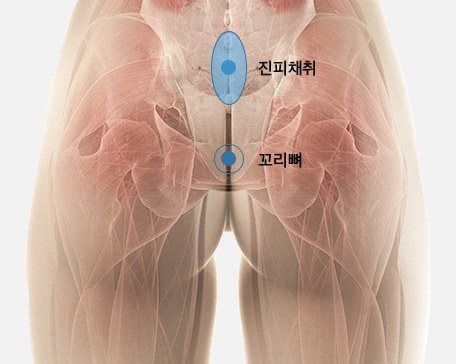 엉덩이 근처 진피채취 부위를 표시한 해부도