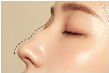 디자인 미스 코 라인을 나타낸 일러스트