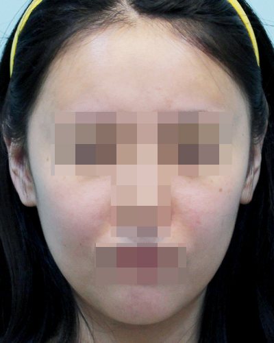 After